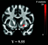 thumbnail image from paper